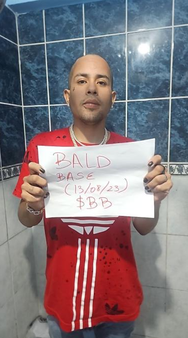 baldbaselol's tweet photo. Would you go $BALD for the current $BB payout ?
#BaldBase members are all shaving their heads and burning tokens.
New winner:
BURN:https://t.co/tDzd99EI2g
REWARD: https://t.co/YtVPg4gUNo https://t.co/WLIhBR8rJl
