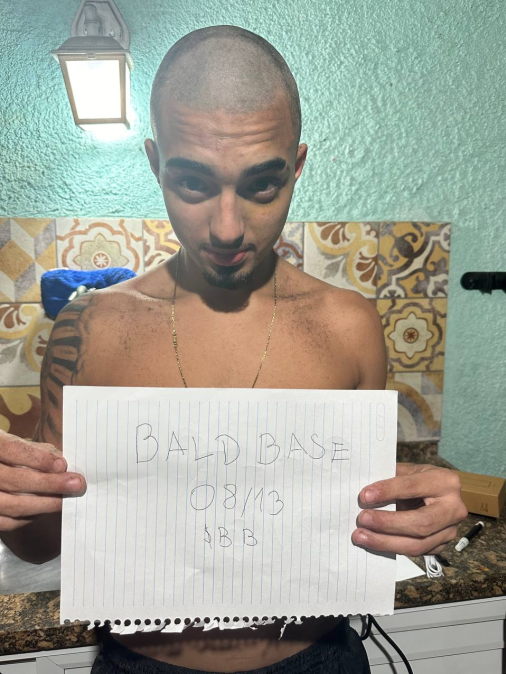 baldbaselol's tweet photo. Another #BaldBase / $BB member officially part of the community !
Burn TX: https://t.co/OGpJkkrrgs
Reward:
https://t.co/bOWoXxmT2q
$BB $BASE $BSWAP #Base #BaseCoin $COIN https://t.co/OGmURaKC9h