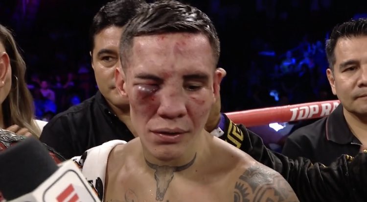 DanRafael1's tweet photo. You don’t play #boxing. #NavarreteValdez https://t.co/tVbjny7uTy