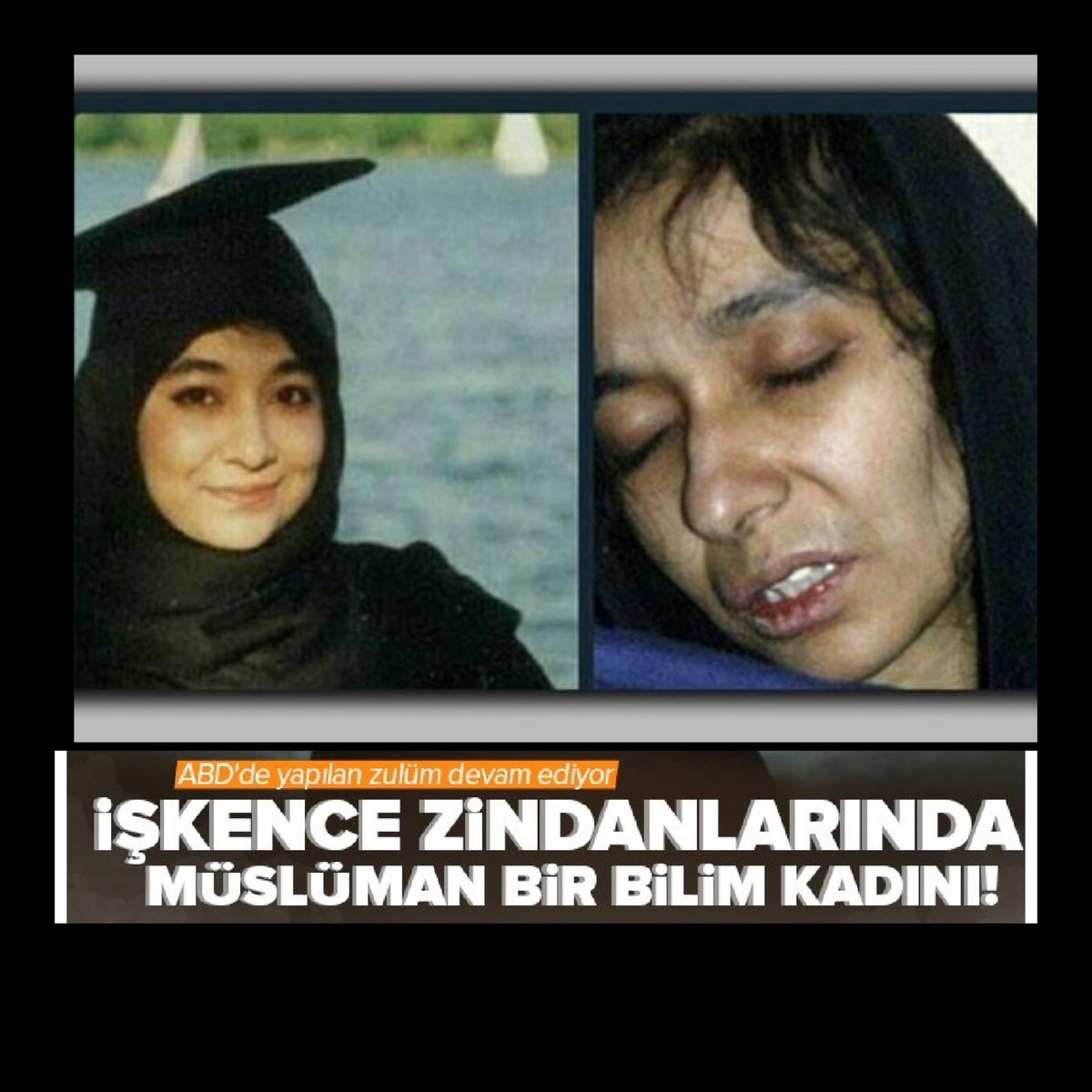 Okuyun - Zaten Paylaşırsınız ⚠️

İsmi Afiye Sıddıki Pakistanlı Müslüman Nöroloji Uzmanı. ABD'nin En Önemli Üniversitelerinden 
Boston ve Massachusetts Teknoloji Üniversitesi Biyoloji Bölümünü 1.'likle Bitirip, Brandeis Üniversitesi’nde doktorasını tamamladı.

Ülkesi 🇵🇰 Pakistan'a