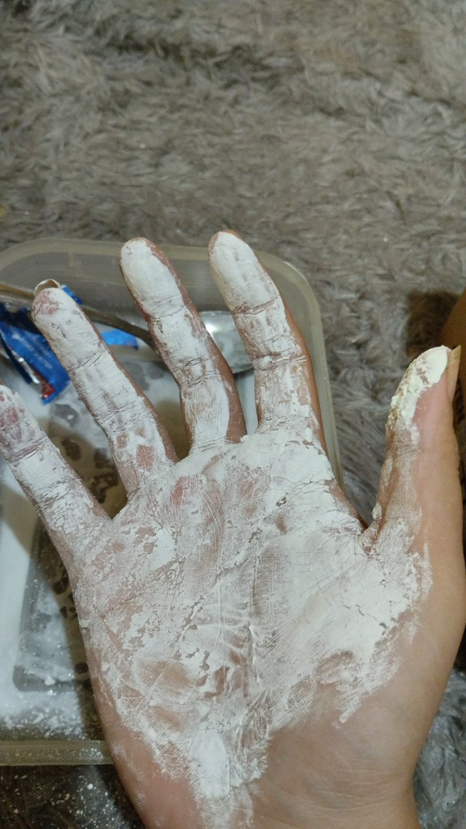 ynnn_i2's tweet photo. @KucengTerbanggg Sangat menderita, tangan kue gatal banget sampe harus di taroh obat gini https://t.co/zfLx8aehtJ