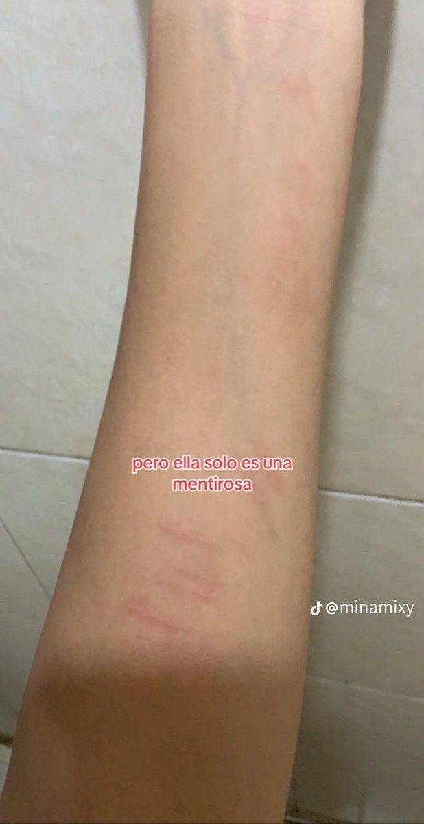 OMG SE LE VE EL HUESO QQQQQ COMO LLEGO TAN PROFUNDO