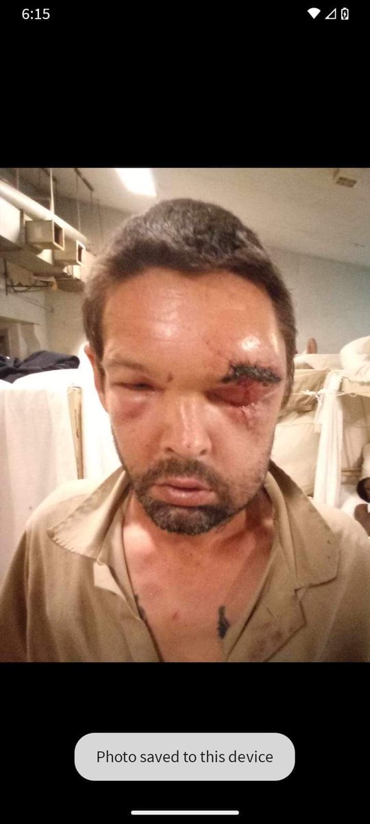 FREEALAMOVEMENT's tweet photo. Thread.
#repost
#alabamaprisons
#freealabamamovement
"Ok guys I need your help. I need calls made to Staton to get Louis Latham #222802 some help. Yesterday evening Mr. Latham was hit upside the head with a weight. They took him to the infirmary and sent him straight back https://t.co/a4DJTaPLmG