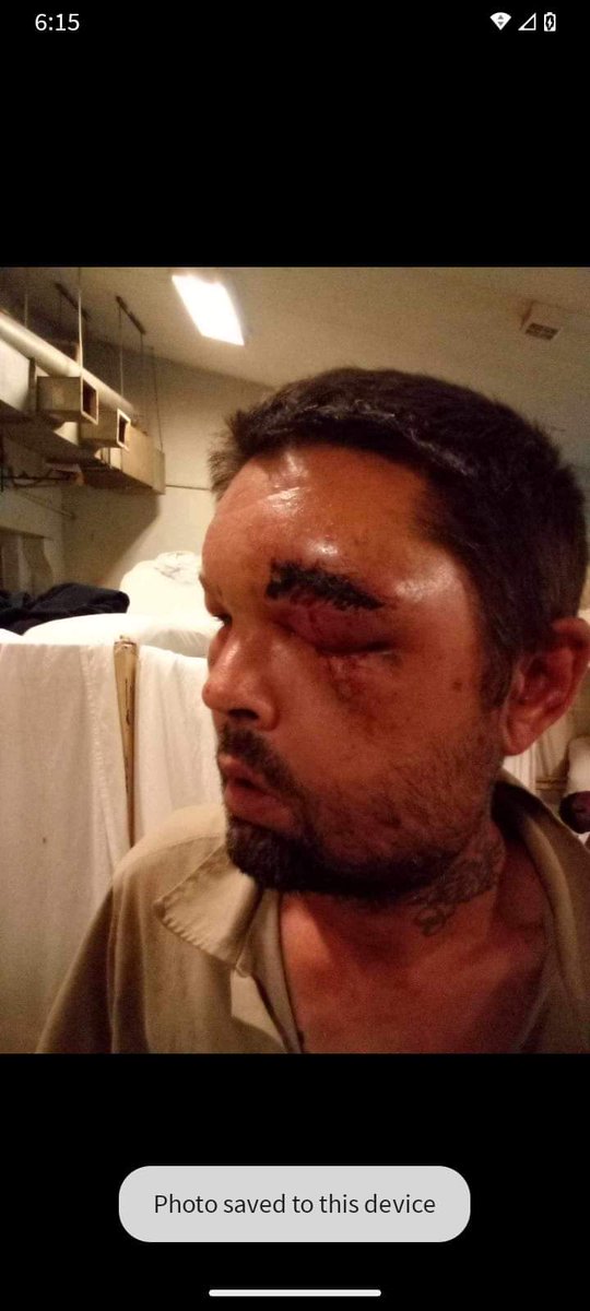 FREEALAMOVEMENT's tweet photo. Thread.
#repost
#alabamaprisons
#freealabamamovement
"Ok guys I need your help. I need calls made to Staton to get Louis Latham #222802 some help. Yesterday evening Mr. Latham was hit upside the head with a weight. They took him to the infirmary and sent him straight back https://t.co/a4DJTaPLmG