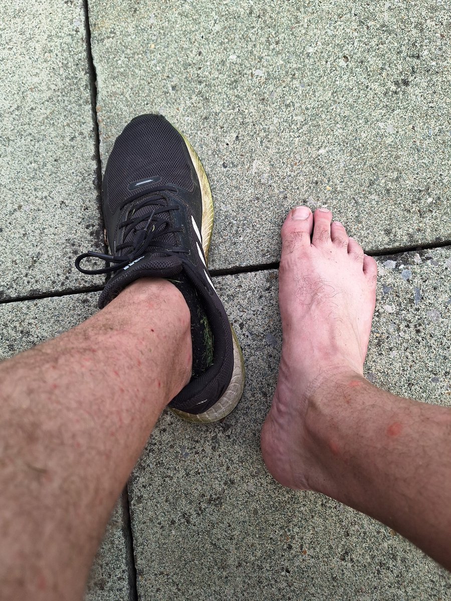 MarshPaul64135's tweet photo. Did a hard day gardening again ! Who wants to see what's the relax method for my 33 year old feet ! https://t.co/7cV0ucWmbi
#sore #workout #feet #feet #feetworld #footrub #freshair #married #natural #feetcare #love #LBGTfriendly #avreagebloke #gardenlife #onlyfannoob https://t.co/yEcKlM67N8