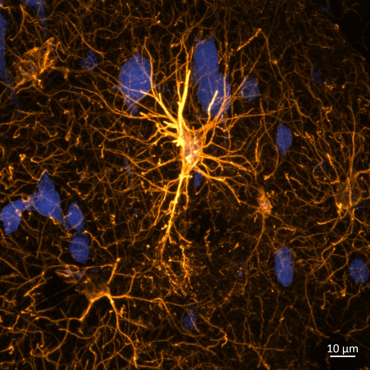 DaniBeckman's tweet photo. I used to think neurons were dramatic until I started looking at astrocytes! Does anyone share this feeling?😁 Markers: neurons - neun🔵, astrocytes - gfap🟡 #SynapseSunday #neuroscience https://t.co/D8kh0URTh6
