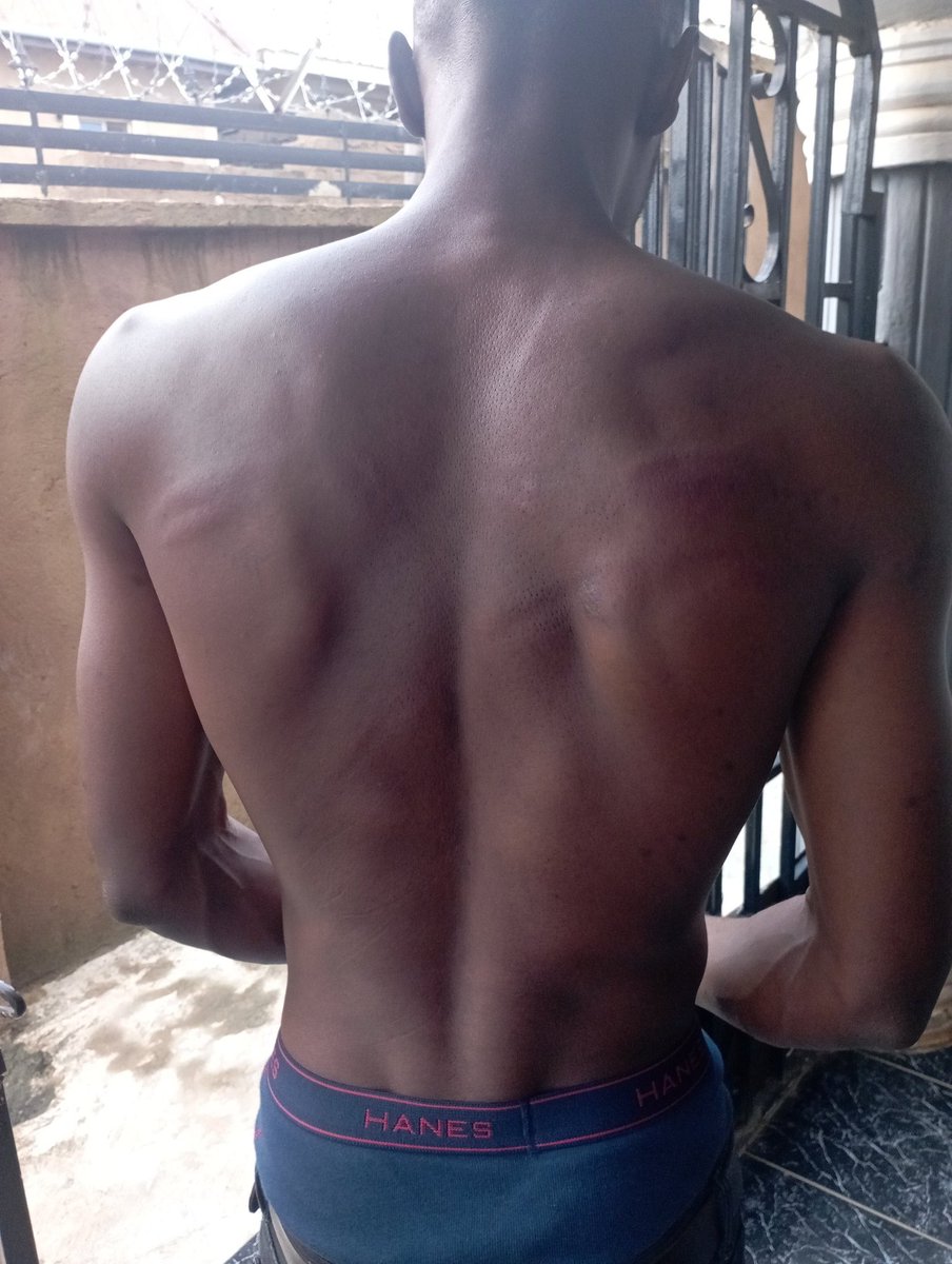 officialmrlin's tweet image. Finally I have been released from the hands of DSS . For just peaceful rally see my body like thief. My eyes still dey shine dey look the judiciary #AllEyeOnTheJudiciary 

@PO_GrassRootM @General_Oluchi @chude__ @AreaFada1  Abuja rally kolos