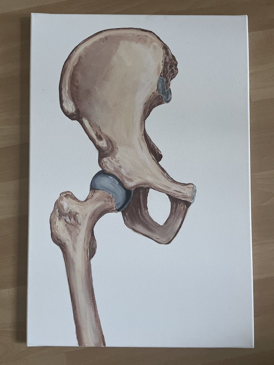 Acryl 

#trauma #medicine #medicalart #medicalillustration #illustration #MedTrauma #MedTwitter #acryl #anatomy #femur #ota #bone #canvas #painting #pelvis #learning #learningbydrawing