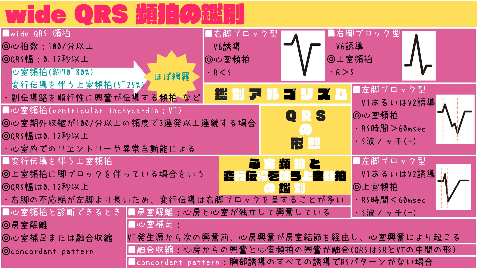 心室頻拍のすべて 突然の動悸という“あるある”シチュエーションで頻拍の診断を考え