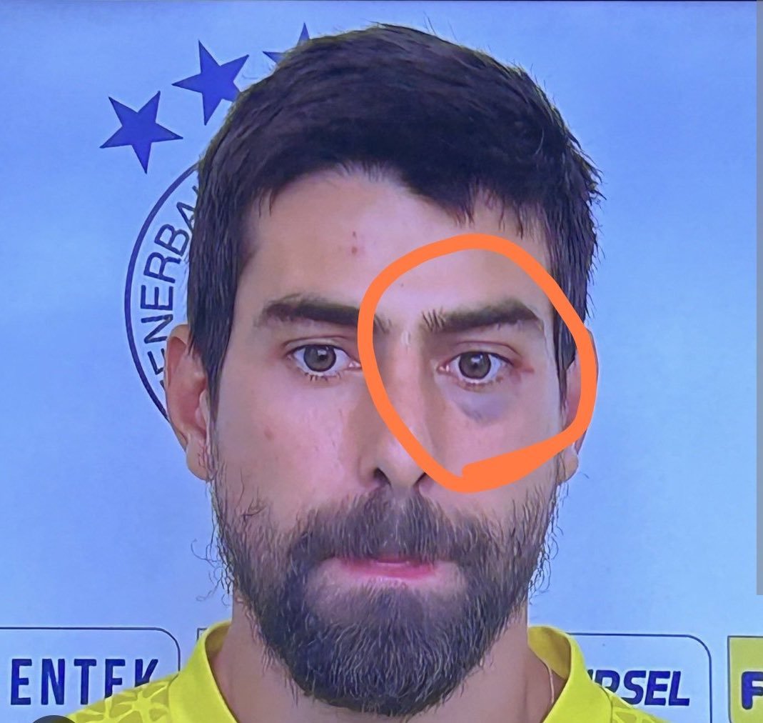 esmerveyso's tweet photo. Kim dövdü mert hakan yandaş mı yoksa İrfan can kahveci mi utanma yok mu dayak atarsın 🤔 😂😂😂😂😂 #fener #samandra #Fenerbahce #fenerinmacivar https://t.co/8ulfWqICWh