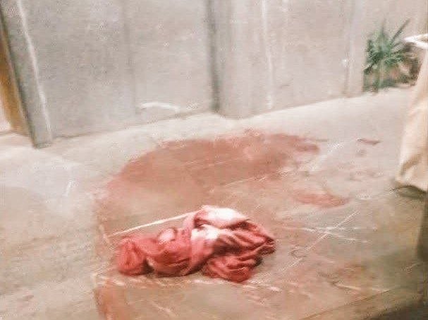 عجب حکایتی دارد این چادر خونی...💔