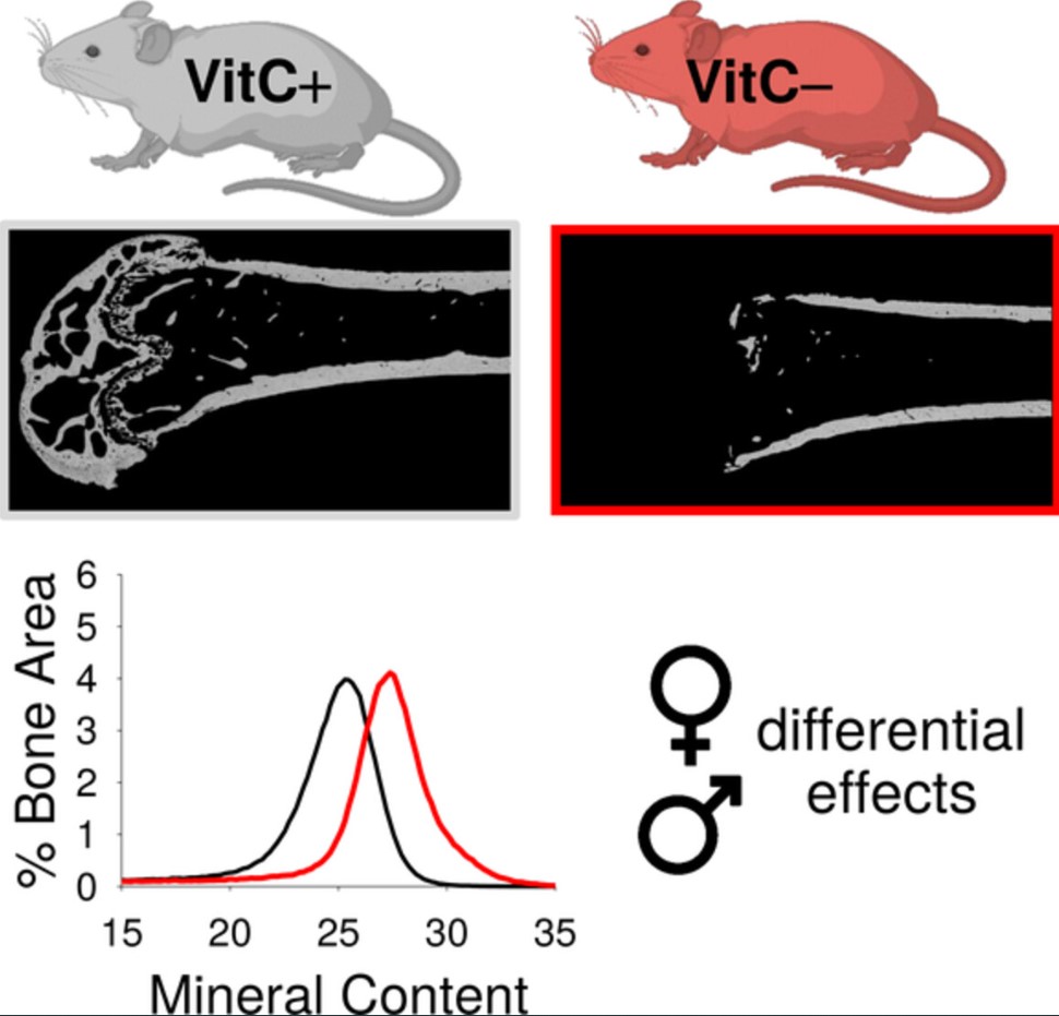 The Journal of Bone and Mineral Research (@the_jbmr) on Twitter photo A new study proposes that low VitC levels may contribute to the higher prevalence of bone-degenerative diseases in females & suggests leveraging this vitamin against these conditions <a href="/RomanThaler/">Roman Thaler</a>
ow.ly/5LLf50Pw5v9 A new study proposes that low VitC levels may contribute to the higher prevalence of bone-degenerative diseases in females & suggests leveraging this vitamin against these conditions <a href="/RomanThaler/">Roman Thaler</a>
ow.ly/5LLf50Pw5v9