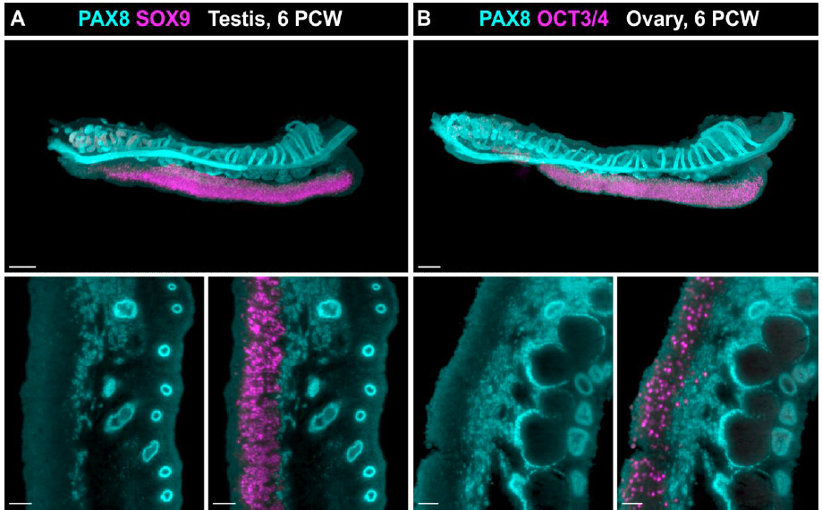 Single-cell transcriptome landscape of developing fetal gonads defines somatic cell lineage specification in humans biorxiv.org/content/10.110…