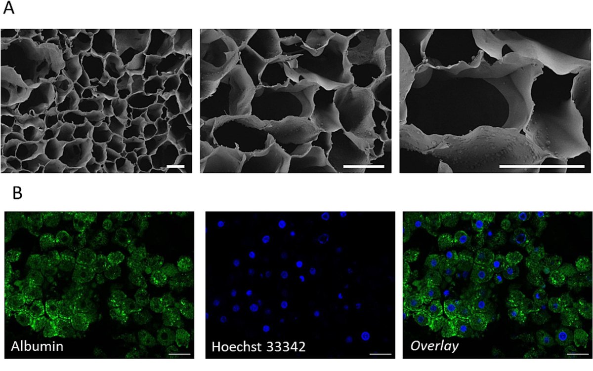 Hepatic Cell News (@hepaticcellnews) on Twitter photo In this <a href="/BiomaterialsAdv/">Biomaterials Advances</a> study, collaborators found that gelatin-hyaluronic (Gel-HA) hydrogels show mechanical properties similar to human liver tissue and improve the functionality of HepG2 cells. 
✅ bit.ly/44WHrSC In this <a href="/BiomaterialsAdv/">Biomaterials Advances</a> study, collaborators found that gelatin-hyaluronic (Gel-HA) hydrogels show mechanical properties similar to human liver tissue and improve the functionality of HepG2 cells. 
✅ bit.ly/44WHrSC
