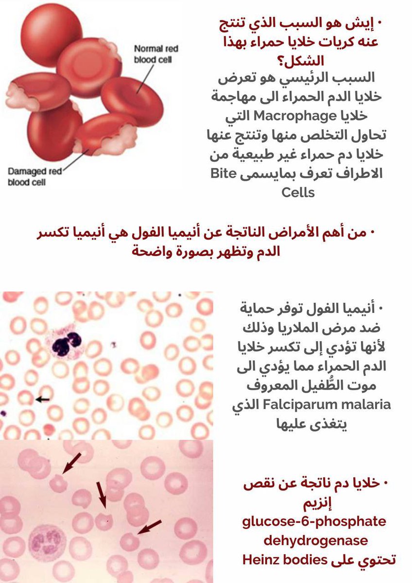 Masma__'s tweet photo. واحد من أكثر الملخصات اللي تعبت عليهم هو هذا 🥰

لخصت أنيميا الفول بشكل كامل وممتع وبسيط أسبابها، كيف تحدث، تشخصيها وأعراضها ✅ https://t.co/WZWzTlmXSW