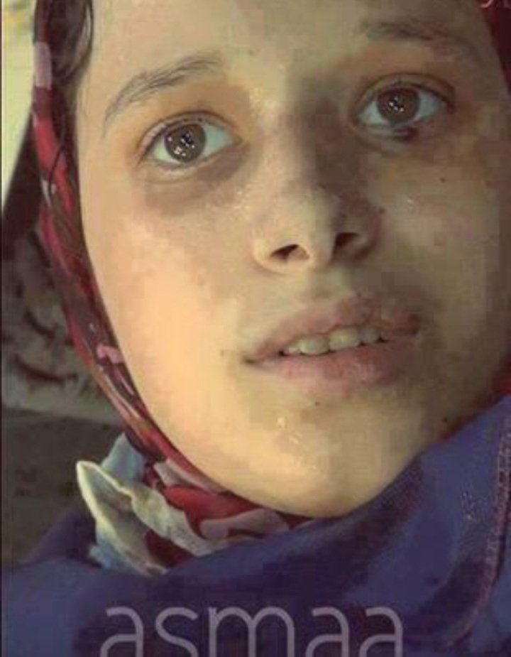 سامحيني يا اسماء...
اذ اضررت يوما  أن انشر صورتك تلك. .
ولكن دعي عينيك تخبرهم
بجريمتهم...
ففي عينيك كل الادلة  ...

نشكوا الي الله ظلم الظالمين... 
________
سناء عبد الجواد 

#حق_رابعة 

<a href="/together_71/">﮼حشد</a>