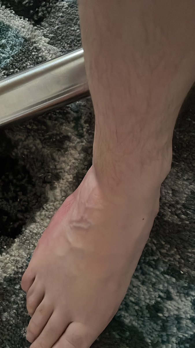 Hrussianfrog's tweet photo. https://t.co/SsLQBrEQUO

#onlyfan #feet_pic #FOOTFETİSH #viral https://t.co/cp0QbF7at4