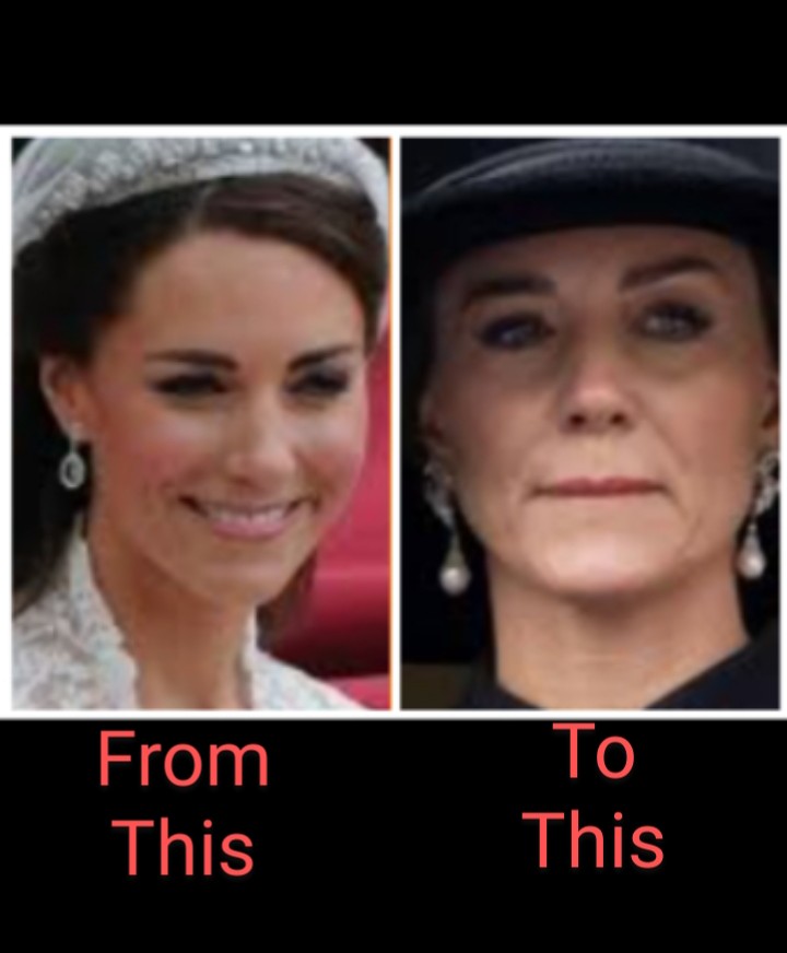 kunjidee1's tweet photo. #KateMiddleton, despite millions thrown at improving her "commonness" thru plastic surg, starving herself &amp; clothing,  hasn't dated well since marrying into the RF ..oh &amp; her parents r broke https://t.co/wEYBPh0Cjo