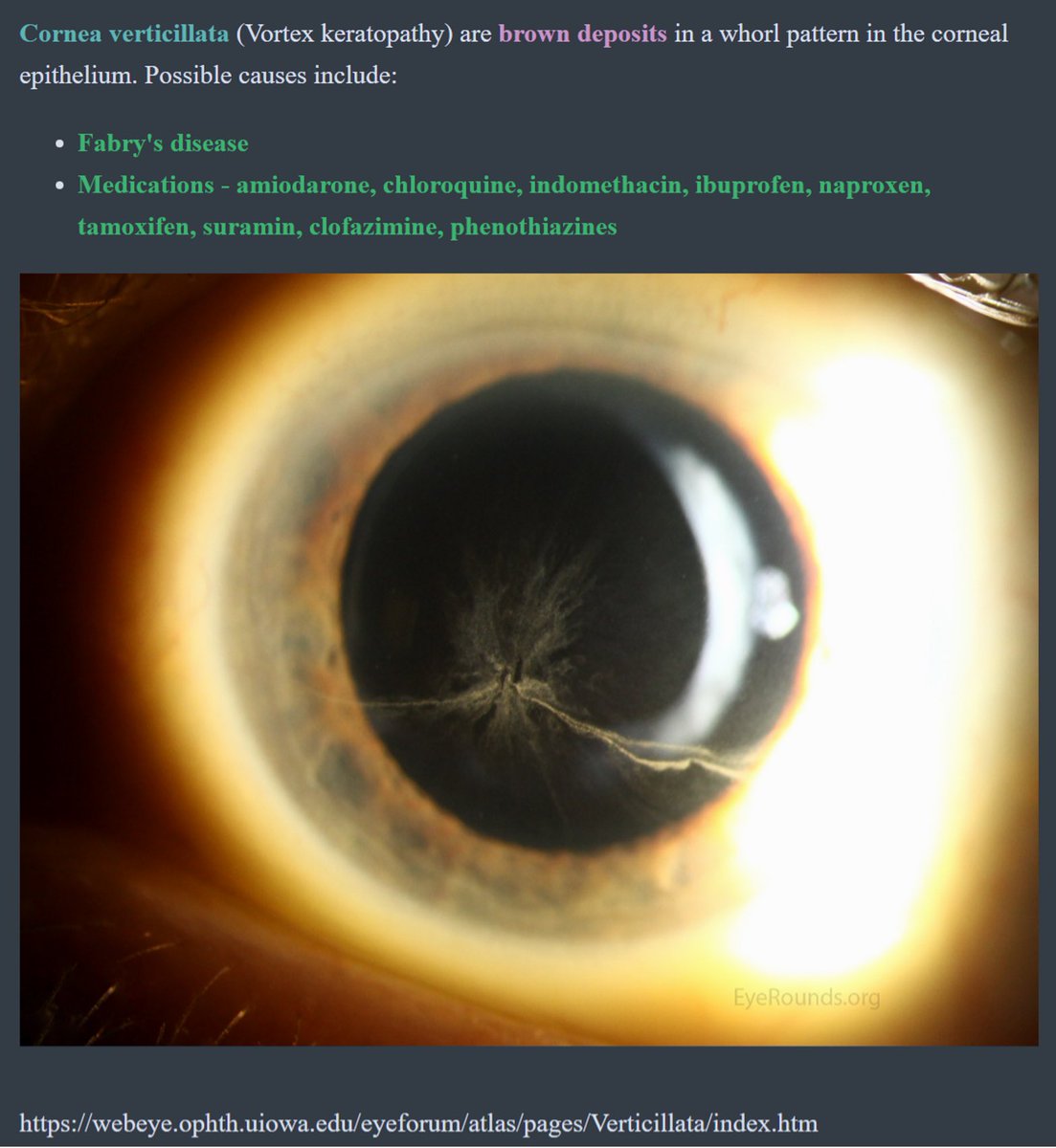 EyeRounds is excited to announce the rollout of our Anki deck platform! 

Expanding multiple subspecialties within ophthalmology, these decks are designed by teams of residents, fellows, and faculty at the University of Iowa to help you succeed on the OKAPS and in clinic.