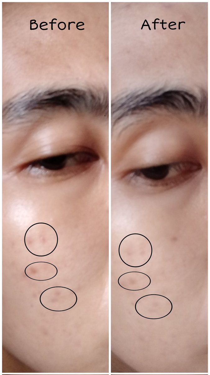 nasikemarennn's tweet photo. guyss aku mau ngenalin nih moist andalan aku akhir akhir ini, yg ngebantu ngurangin kemerahan di wajah dan menenangkan kulit berjerawat

__Calm Down Skinpair R-Cover Cream__ https://t.co/bPGt7HEEr5