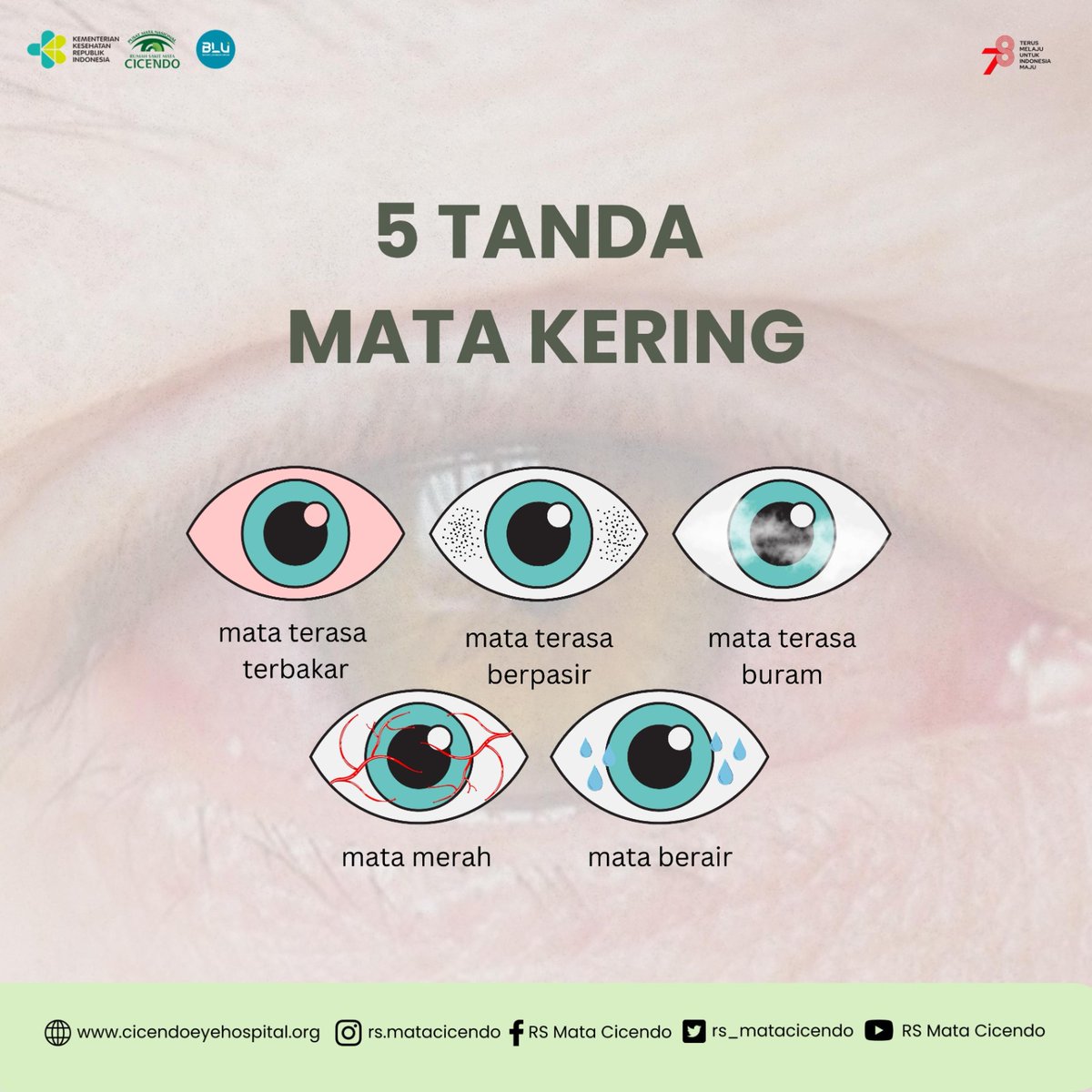 rs_matacicendo's tweet photo. Sahabat Mata, bila menemui beberapa Tanda Mata Kering inj, segera periksakan ya !
#salamsehatmata #matakering #rsmatacicendo https://t.co/Yqijgr5htt