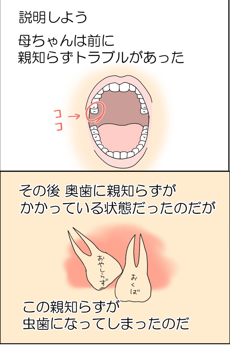 歯が飛んだ話 2/4 