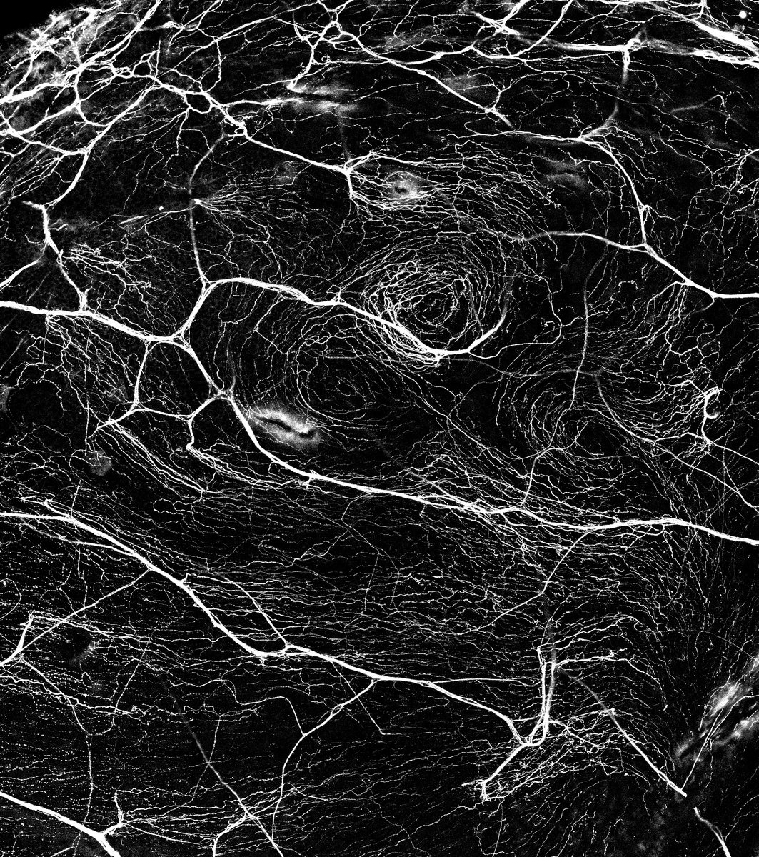 NeuroAlc's tweet photo. #SciencePhoto_IN
"The starry night"
Author: Dr. Almudena Íñigo @_aLmU_ 
Lab: Dra. Juana Gallar @GallarJuana Dra. Mª Carmen Acosta Dr. Víctor Meseguer
"Cornea pattern of sensory nerves forming whirl-like structures that reminds us of van Gogh's masterpiece. @zeiss_micro LSM880." https://t.co/QPz177JZvi