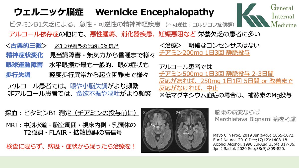 【中古】 ウェルニッケ・コルサコフ脳症 Wernicke脳症 ・アルコール依存症の他にも栄養欠乏の患者にも起こり