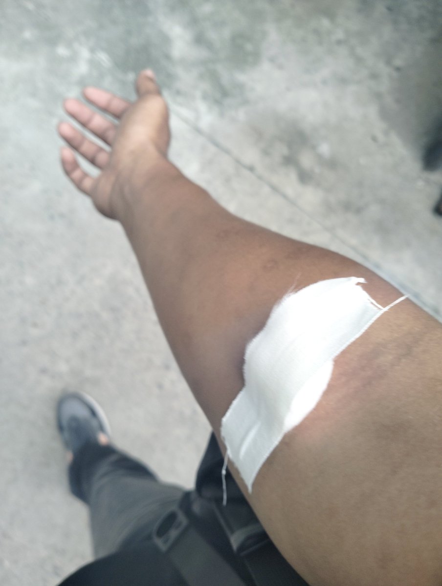 dave74476244's tweet photo. JUST HAD MY VL TEST TODAY..
HOPING FOR BEST RESULT ❤️❤️ https://t.co/tNu4uN9fjM