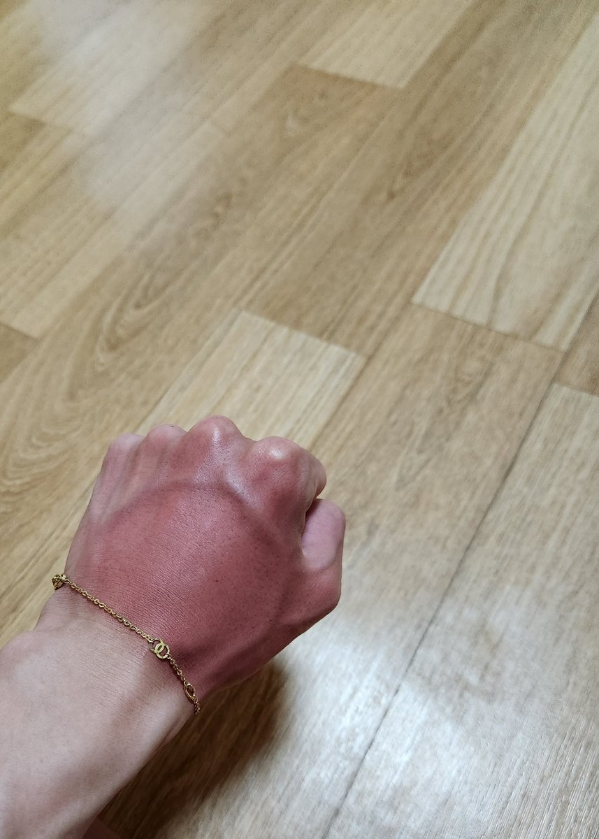 썬크림...  바르세요...