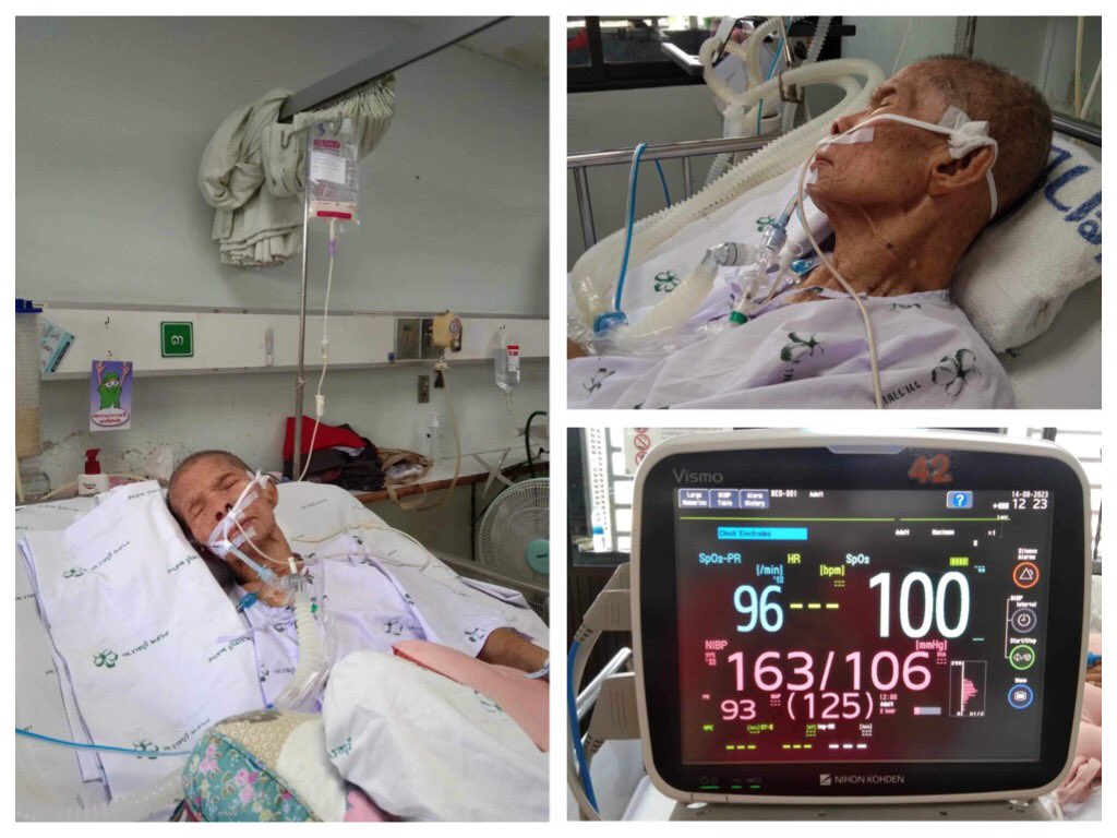 TakongWipa's tweet photo. I went to the hospital to feed my dear daddy ❤️ a tube lunch. 
Dad looks better today. 😊
But still can't remove the ventilator. 😞
After finishing the meal, Dad slept very well. 🥰 https://t.co/59LdCmV77N