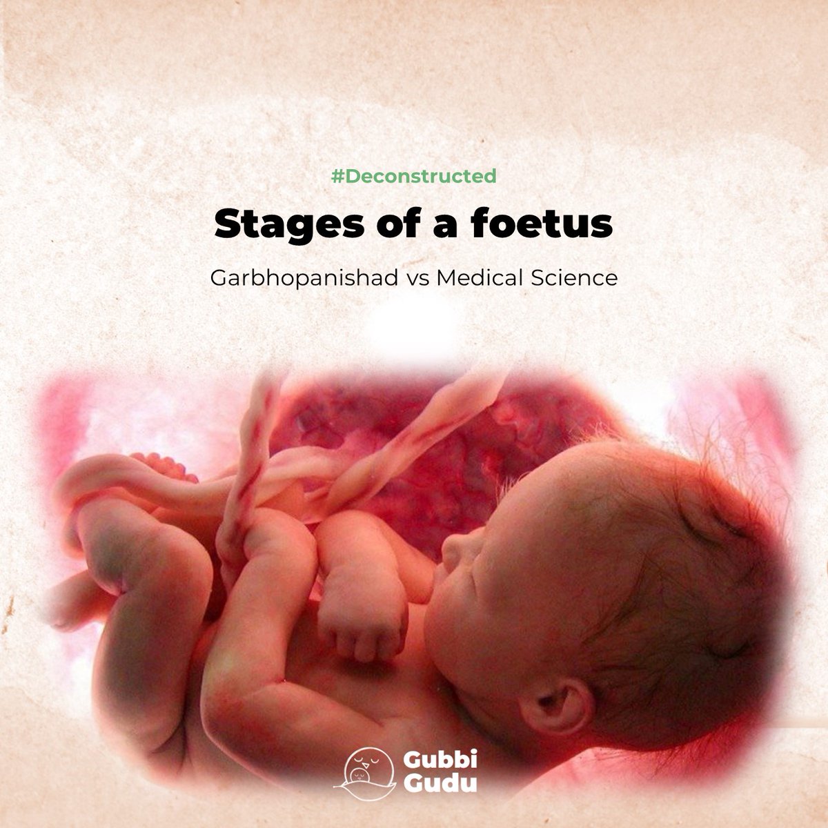 bygubbigudu's tweet photo. 👶📚 Gubbi Gudu Deconstructed: Unraveling Pregnancy's Wonders! 🤰🔍⠀ https://t.co/Ejb3VLUD1l