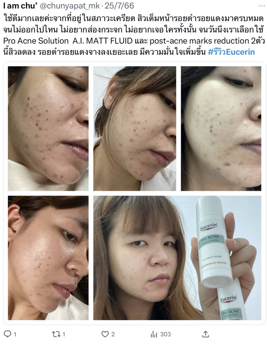 sweetie2store's tweet photo. Eucerin A.I. matt fluid
ตัวขายดีของคนเป็นสิว

- ช่วยลดสิวอุดตัน
- ลดรอยดำ รอยแดง จากสิว
- ช่วยคุมมันยาวนาน 8 ชั่วโมง

ราคา : 590฿ ส่งฟรี 
( ซื้อคู่ถูกกว่า 1160 )

#eucerin #ยูเซอริน  #ยูเซอรีน #ใช้ดีบอกต่อ #บ้านเช่าบูชายัญ #สกินแคร์รักษาสิว https://t.co/6acEaQxEPy