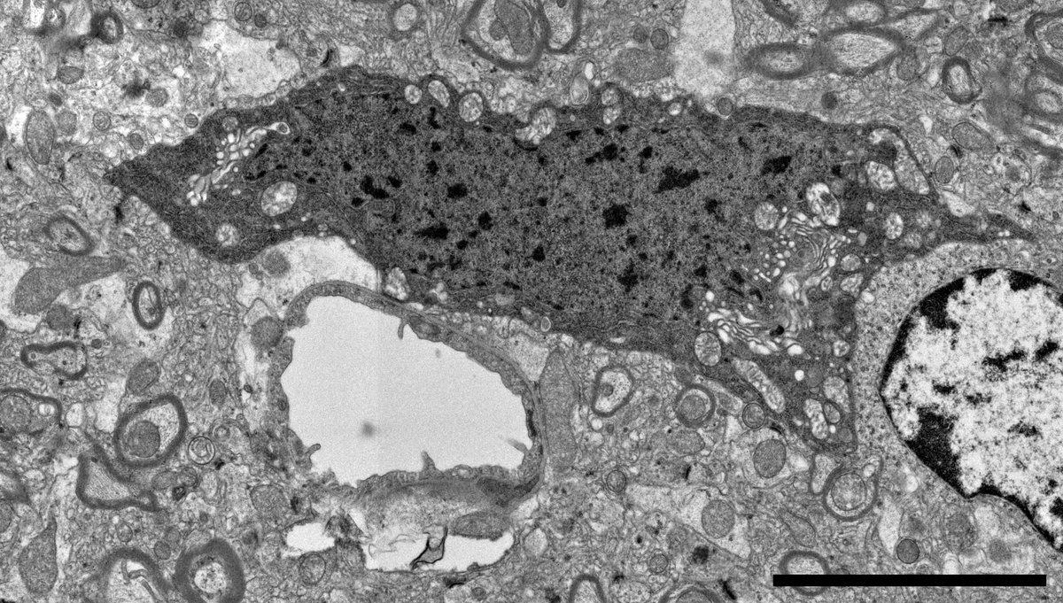In our recent study doi.org/10.1111/bpa.13…, in addition to vascular changes in brains of Xpr1 +/- mice, we also observed “dark microglia” and microglia with fibrillar inclusions. What are these microglia doing – yet to figure out...#microglia #pathology