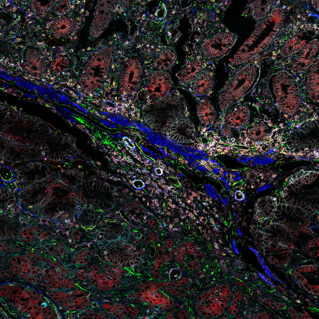#MultiplexingMonday
📚 Want to learn more about how #OpenMultiplexing is transforming tissue research? 💯 
🔶 Check out this webinar and discover how you can visualize 60+ biomarkers of your choosing on a single tissue sample with #CellDIVE.  
👉 fcld.ly/2xptkd7