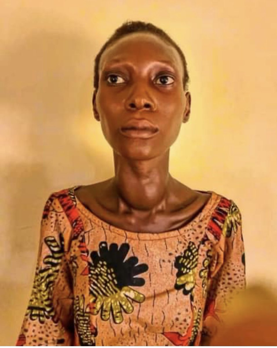 fapeffoundation's tweet photo. Hajiya @lamiAUF Fintiri, the wife of the Governor of Adamawa State, demonstrated her compassion, charity, and generosity by extending a helping hand to Hadiza Umar, a 21-year-old girl suffering from toxin goiter. https://t.co/I6uhtG3oRZ