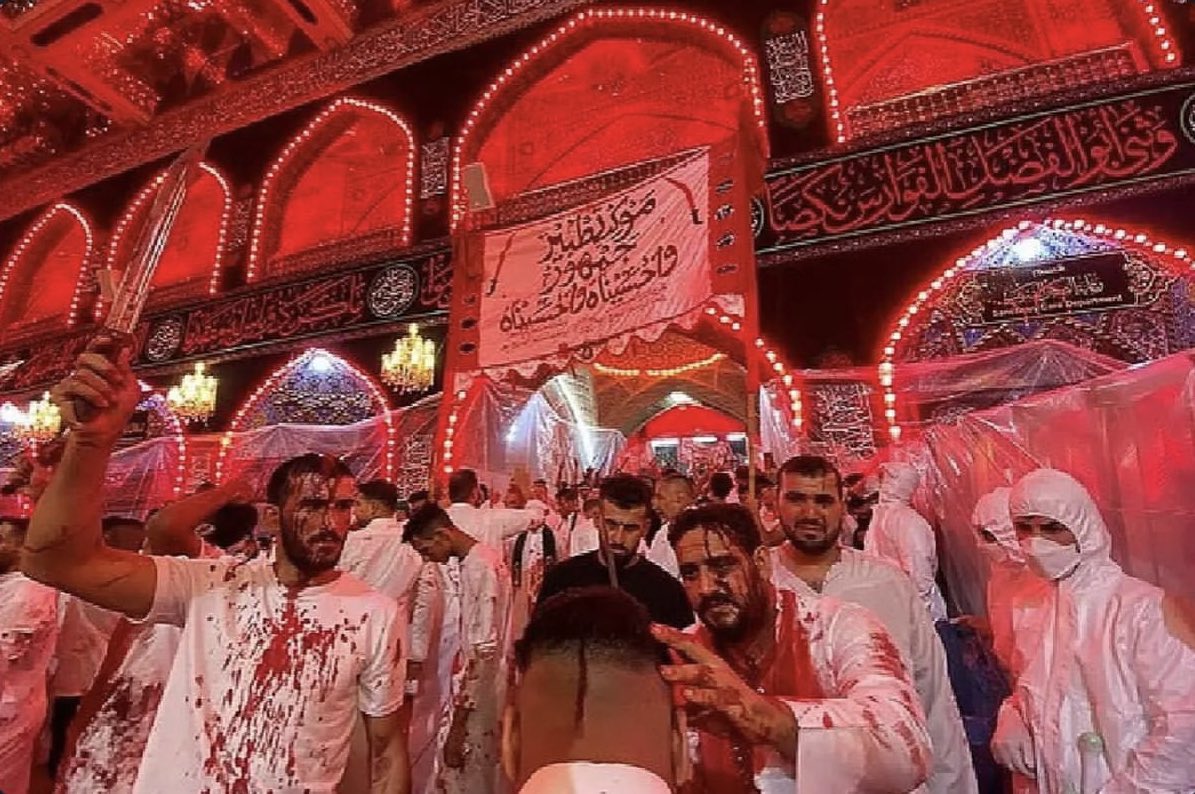 alipm725's tweet photo. اینا خیلی نرمال و عادی هستن
ولی مایی که تتو میزنیم مشکل اعصاب و روان داریم :/ https://t.co/qDhtmmr39f