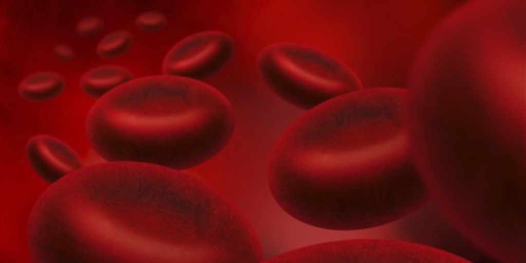 #BloodDisorders known as myelodysplastic syndromes/neoplasms (MDS)  are commonly #misdiagnosed – putting patients at increased risk for treatment mistakes and other potentially harmful consequences: bit.ly/45qQbAu #misdiagnosis #PatientSafety