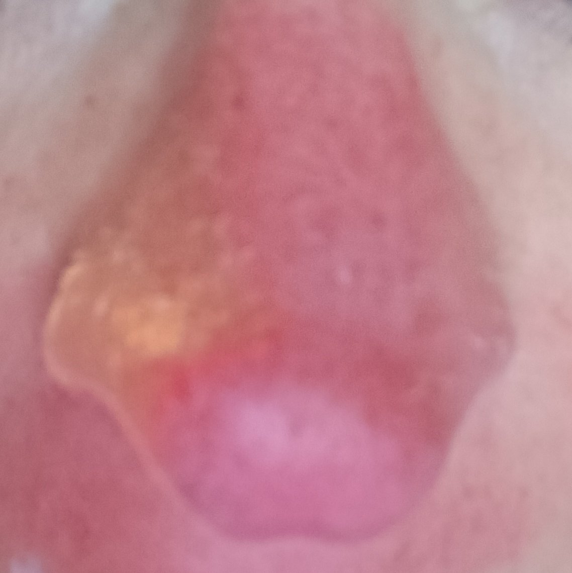 JacquelineDull2's tweet photo. Je zal je neus toch verbranden🤔🤔🤔 https://t.co/0cFWTG45Be