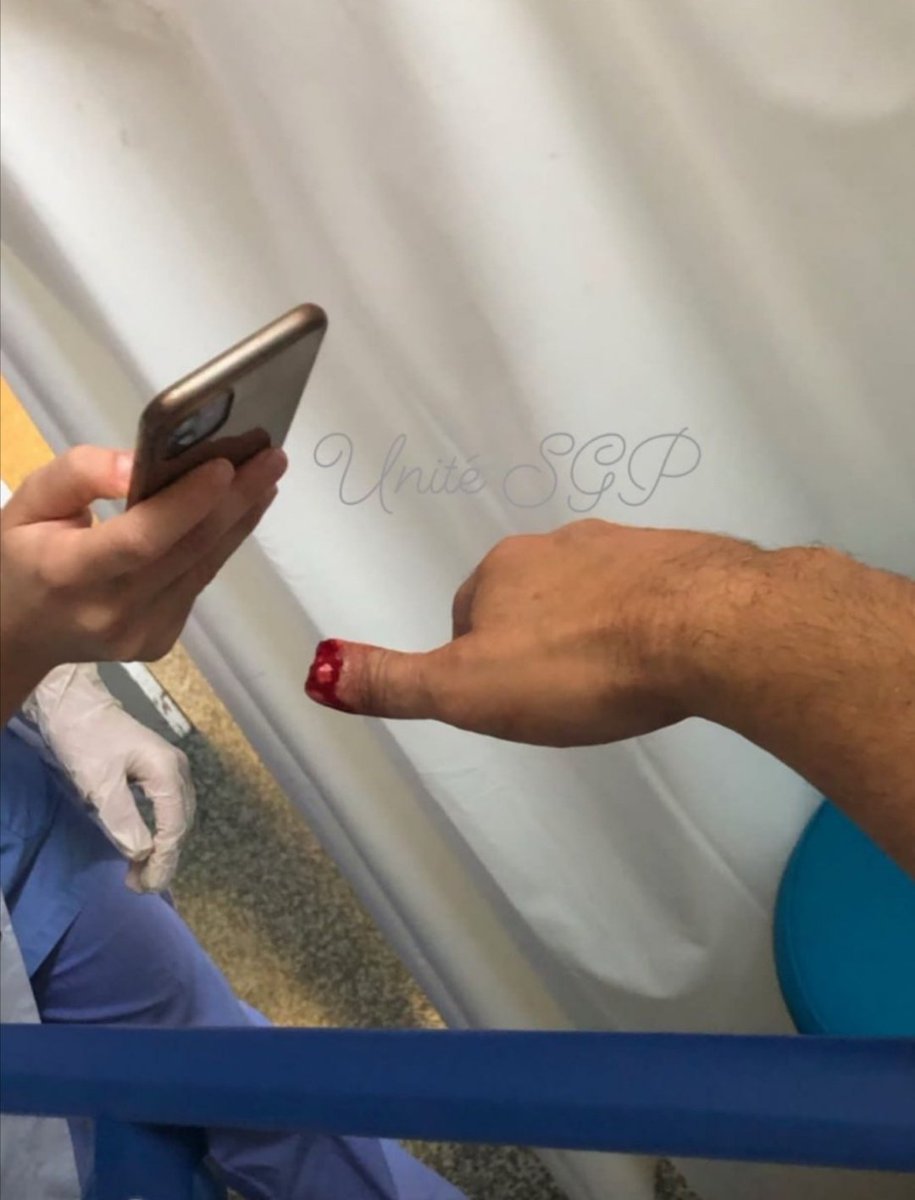 GilbertCollard's tweet photo. Un policier de la BAC de La Rochelle s'est fait mordre et arracher un bout de doigt par un individu interpellé sur la plage hier : des barbares... mais où est passée la civilisation ?

src : SGP https://t.co/1vZPk8jC26