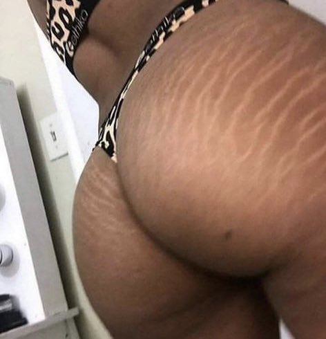 I love Tiger marks😍🥵 https://t.co/wjNV1lcKEK<a href="/tag/masturbation"class="tags"><span>#masturbation</span></a><a href="/tag/dildo"class="tags"><span>#dildo</span></a><a href="/tag/bigass"class="tags"><span>#bigass</span></a><a href="/tag/squirt"class="tags"><span>#squirt</span></a><a href="/tag/amateur"class="tags"><span>#amateur</span></a>