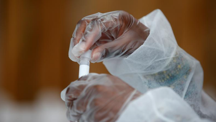 SABCNews's tweet photo. South African Medical Association (SAMA) says a new COVID-19 variant has been discovered, EG. 5 last week Thursday.  

https://t.co/x4daRKAmhu https://t.co/IwrzVxrXQO