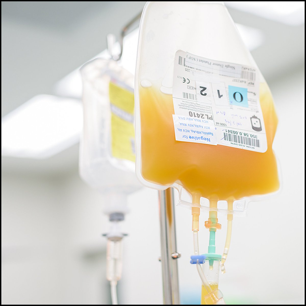 ASALifeline's tweet photo. In a new study published in @_Anesthesiology, delayed cold-stored platelets were associated with higher postoperative transfusion use and lower platelet counts compared with room temperature-stored platelets, with no difference in clinical outcomes: https://t.co/1VxrnNd8Vw https://t.co/5baD85h0tL
