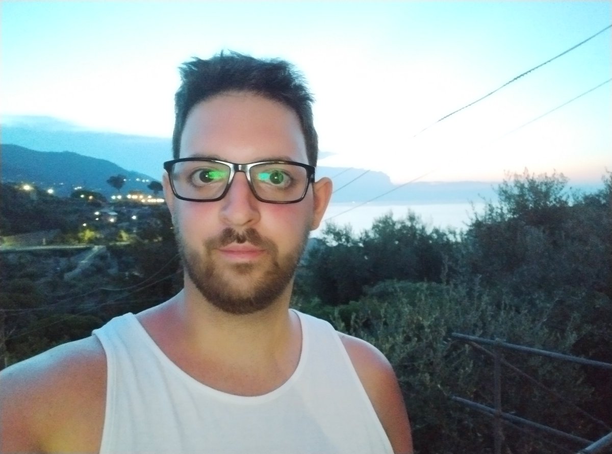 Matthiapzn's tweet photo. Primo giorno di sole, bello scottato. 

Stasera crema! https://t.co/OKkdOYYktP