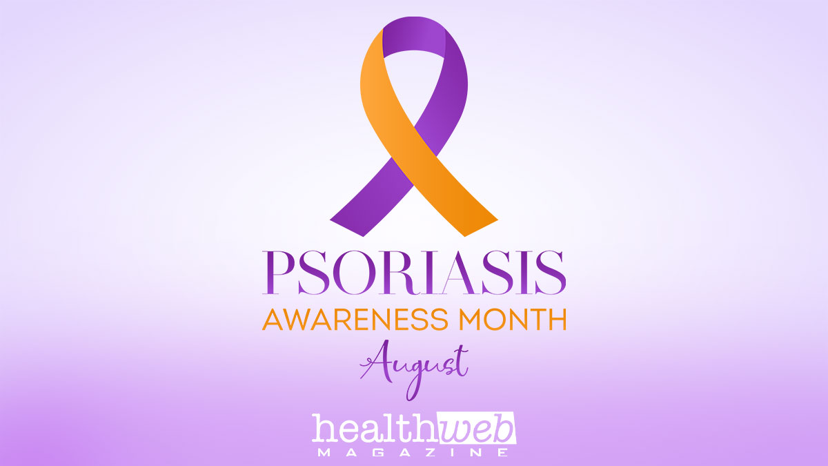 August is #PsoriasisAwarenessMonth which aims to help affected people feel supported, raise awareness and give the public a better understanding of the disease. #Psoriasis #skindisease #autoimmuneskincondition #Plaquepsoriasis #skindisorder #psoriasissymptoms #psoriasistreatment