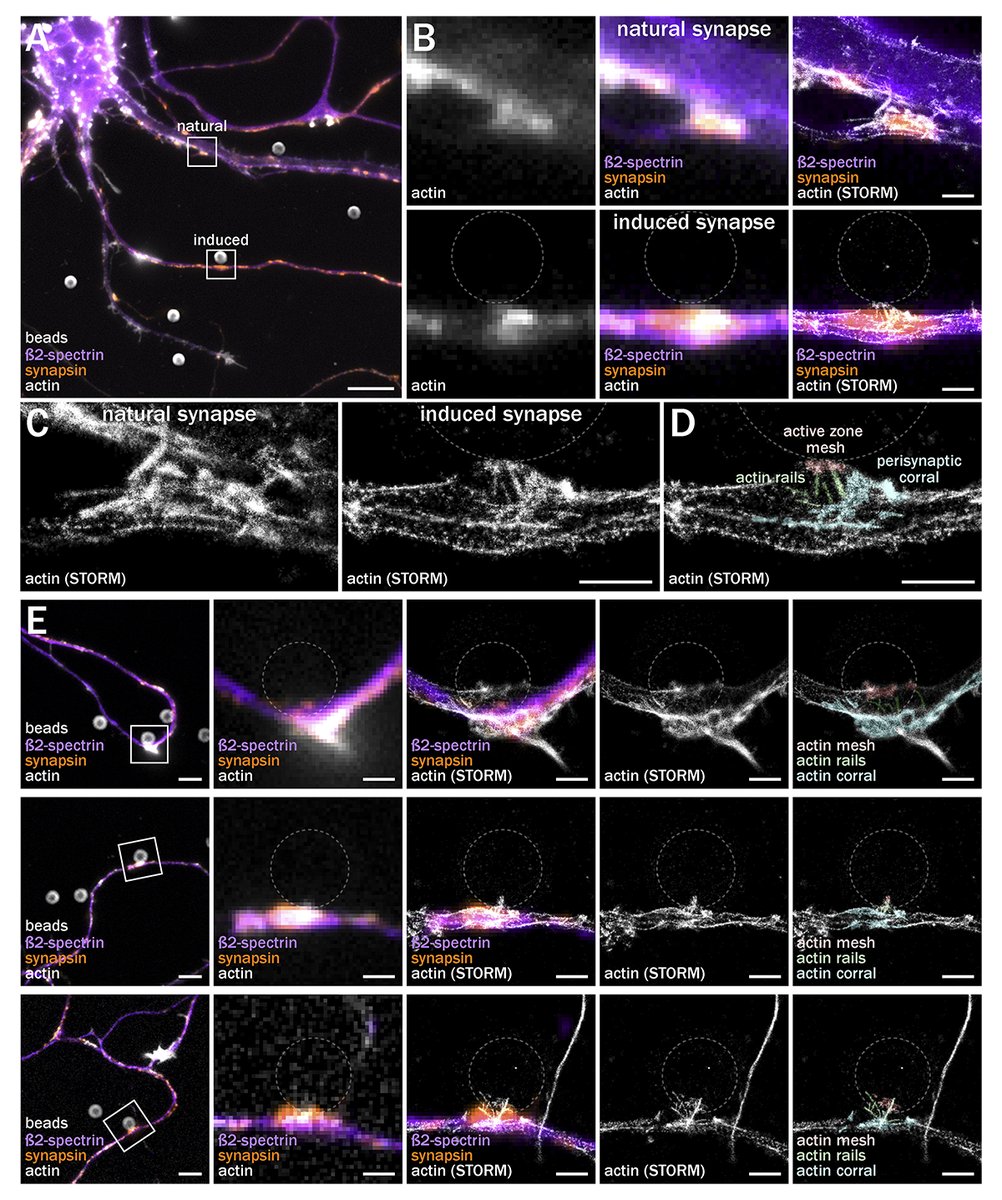 RockUPress's tweet photo. In @JCellBiol, @dombingham @christlet et al use bead-induced presynapses and CRISPR-tagging of endogenous #actin coupled to STORM to reveal distinct actin nanostructures within presynapses: a mesh at the active zone, rails, &amp; perisynaptic corrals https://t.co/sW16TJxg6t
@Dr_majio https://t.co/B4mkRLguYI