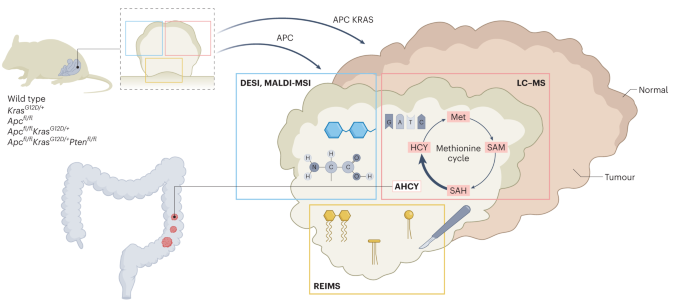 Online now! Multimodal metabolomics pinpoint new metabolic vulnerability in colorectal cancer dlvr.it/StdqRX