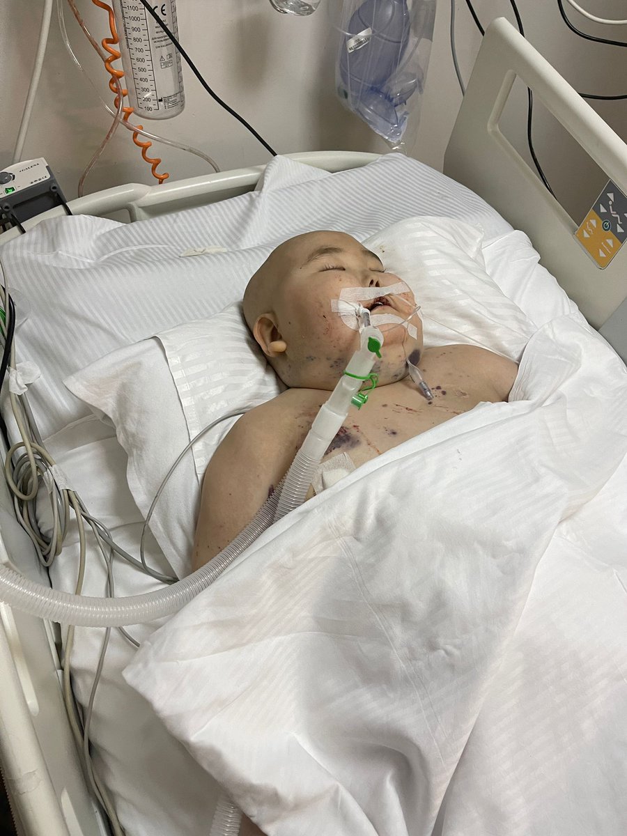 DİKKAT!
DURUMU KRİTİK!!

Yoğun bakımdaki Moğolistanlı lösemi hastası bir miniğin hayati durumu kritik. B Rh+, B Rh-, AB Rh+ kan gruplarından kan ihtiyacı vardır. Haydi hayata tutunmasına vesile olalım. Onun için de gökyüzü mavi olsun

Yer: Bahçelievler Medikal Park

05317216132