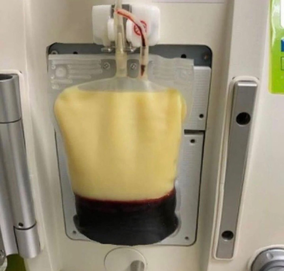 doei sangue hj 🩸❤️❤️