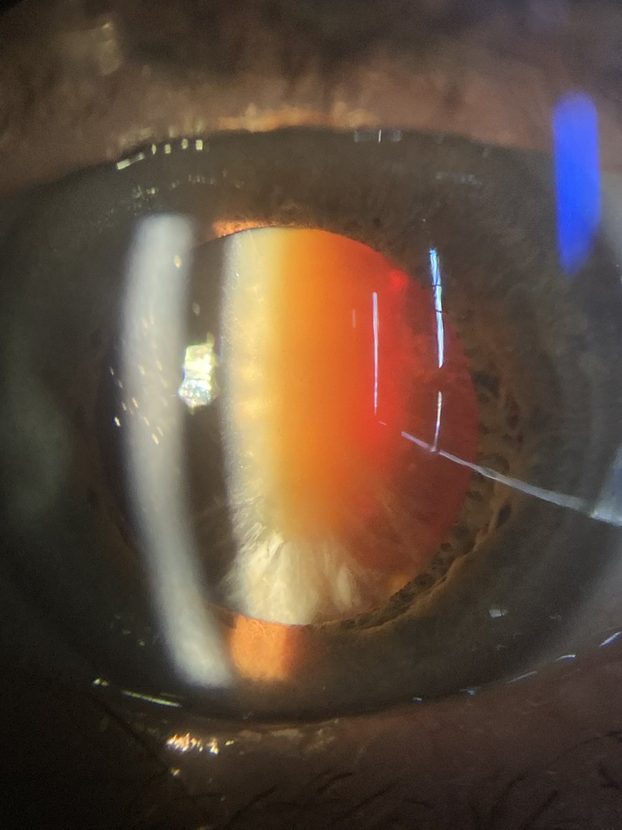 DBerronesM's tweet image. 🥵 SICS bound